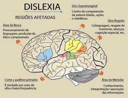 Regiões afetadas pela dislexia